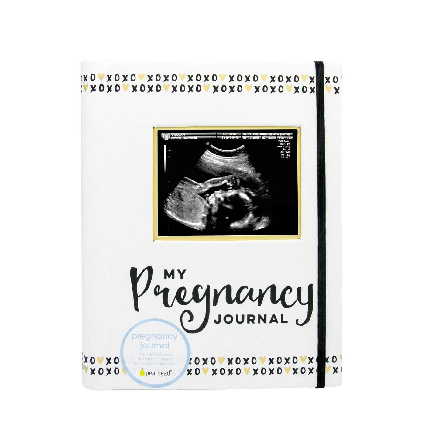 Pregnancy Journal, Black White & Gold